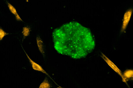 Fluorescent molecules glow in water, enhancing cell imaging Fluorescent molecules glow in water, enhancing cell imaging