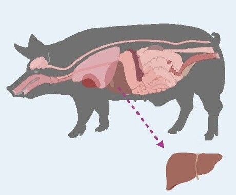 Pig-to-human liver xenotransplant conducted in a living recipient Pig-to-human liver xenotransplant conducted in a living recipient