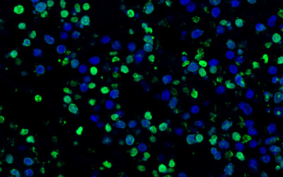 CST cellular assay kits