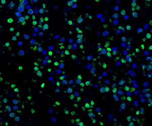 CST cellular assay kits CST cellular assay kits