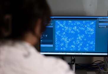 Reproductive impacts of PFAS exposure revealed