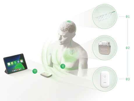 Synchron raises $305m to advance brain&ndash;computer interfaces