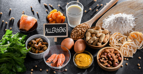 PEAL Is Here: Why Front-End Allergen Control Matters More Than Ever