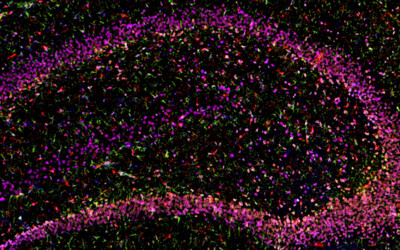 Proteintech CoraLite Plus-Tyramide reagents and detection kits