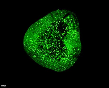 Map of the developing brain opens pathways to treat Parkinson&#39;s