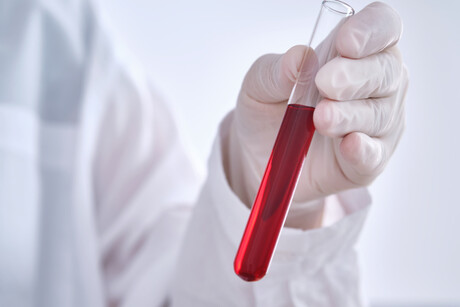 Elevated blood protein levels predict mortality