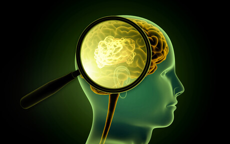 Customised immune cells used to fight brain cancer