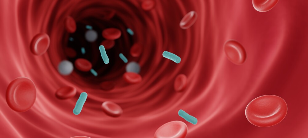 Have Australian researchers discovered the secret to treating sepsis?