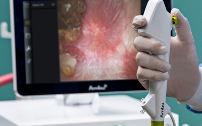 Ambu aScope 5 Uretero single-use scopes