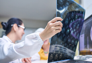 Can yawning advance the study of neurodegenerative diseases?