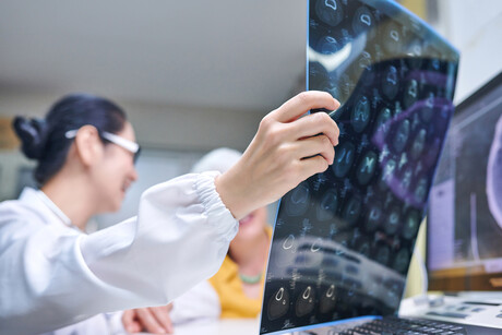 Can yawning advance the study of neurodegenerative diseases?