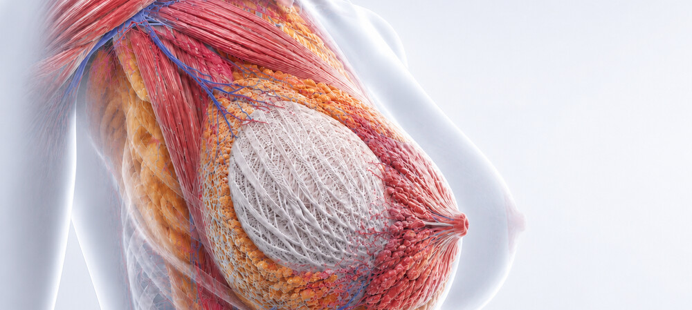 Absorbable scaffolds regenerate lost breast tissue