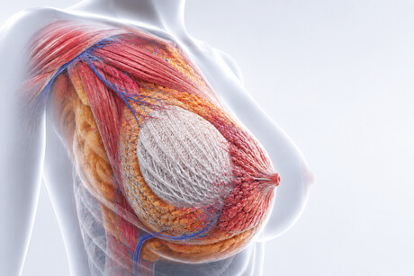Absorbable scaffolds regenerate lost breast tissue