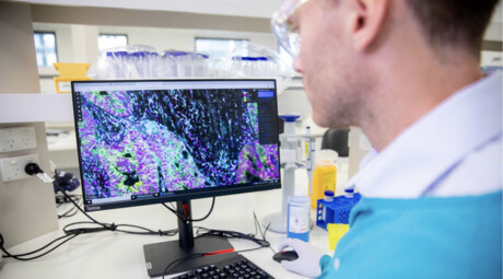 Could this human tissue biobank find the cause of a bowel cancer surge?