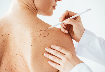mRNA therapy found to prevent recurrence of melanoma
