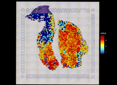 Heart muscle regeneration genes mapped