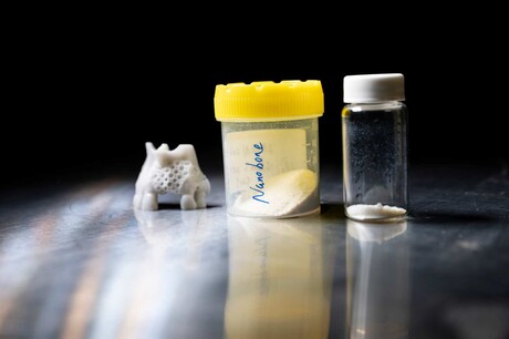 Could this 'nanobone' material allow children to regrow bone?