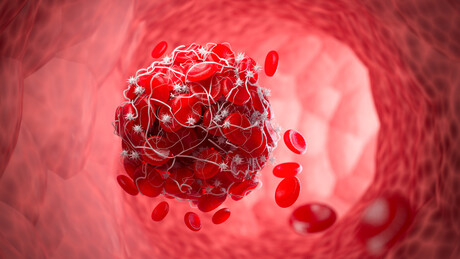 Biodegradable smart patch can detect and treat blood clots
